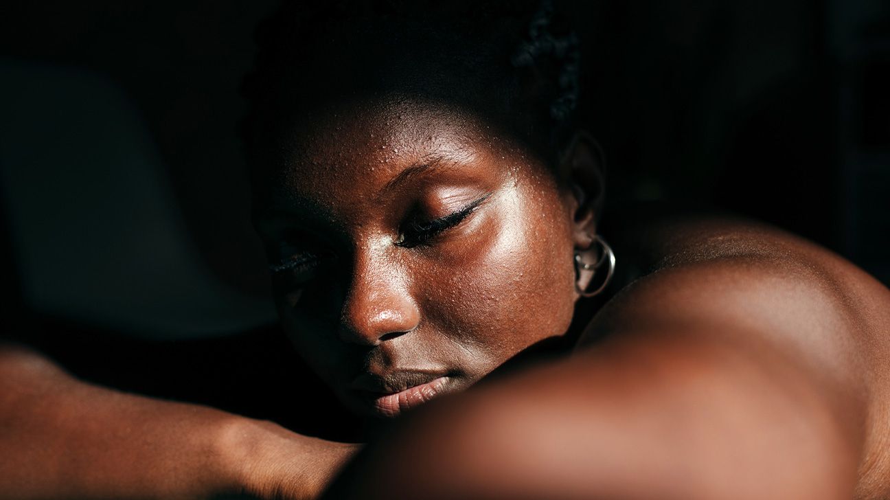 A portrait style photograph of a Black woman with rosacea bumps on her face.