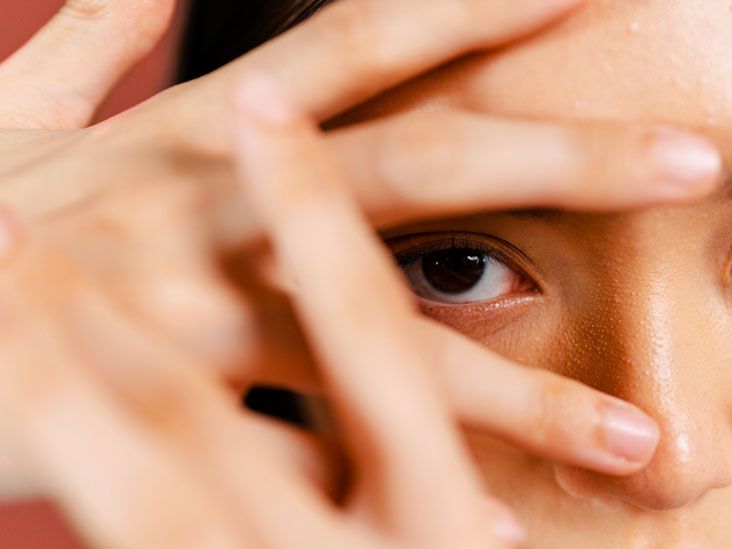 Can Thyroid Eye Disease Cause Blindness? And More FAQs