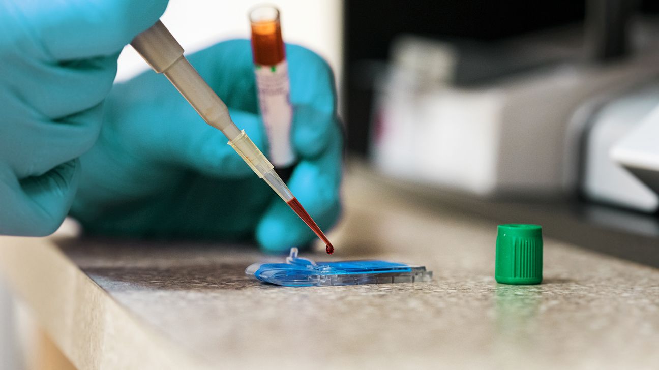 testing blood in a lab