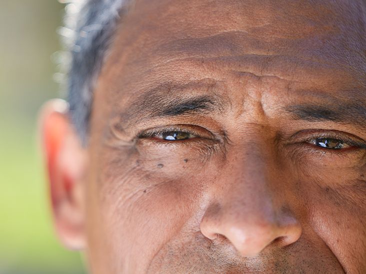 What Is Eccentric Viewing and Can It Help If You Have Wet AMD?