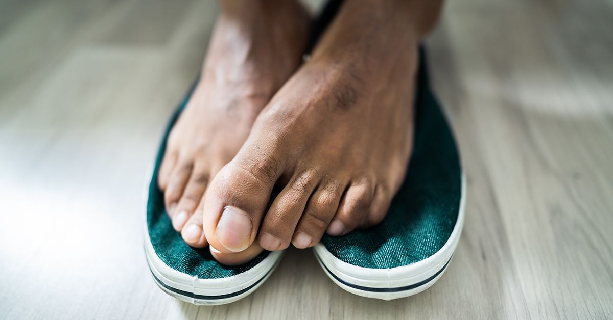 Gout Stages, Preventing Progression, Treatment, and FAQ