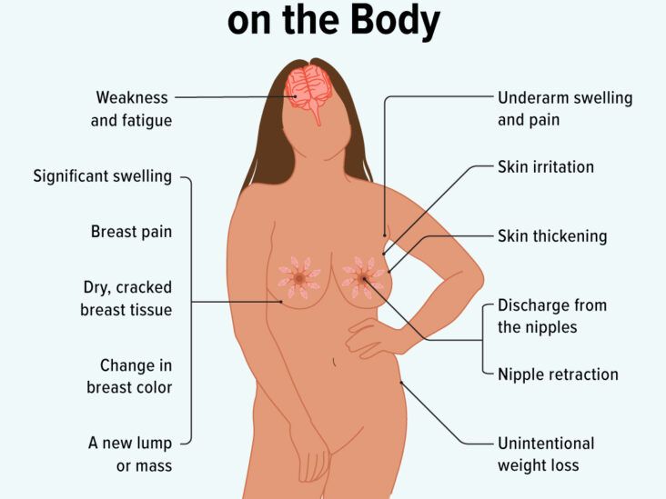 How Breast Cancer Affects the Body