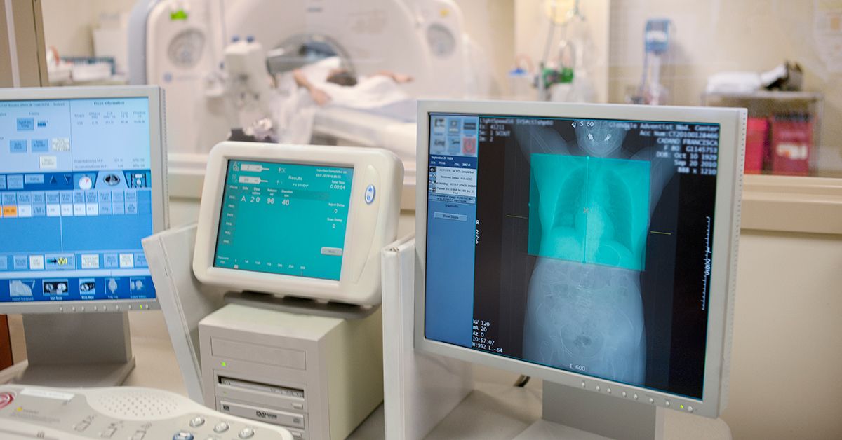 Benign Lung Nodules Symptoms, Causes, and Treatment