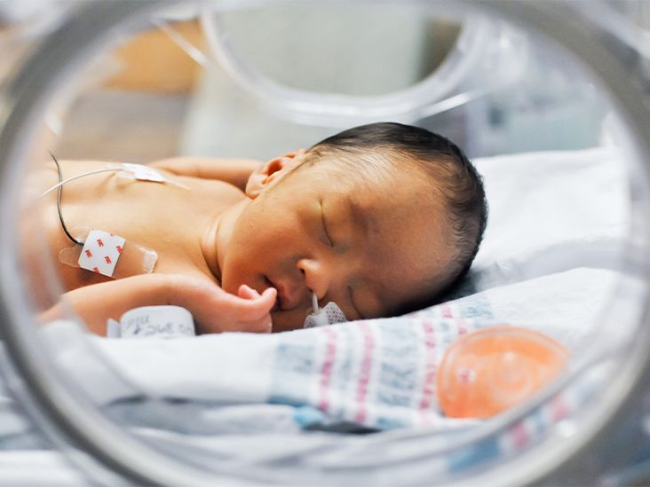 Premature Births Have Increased 12% In the Past Decade, CDC Report Says