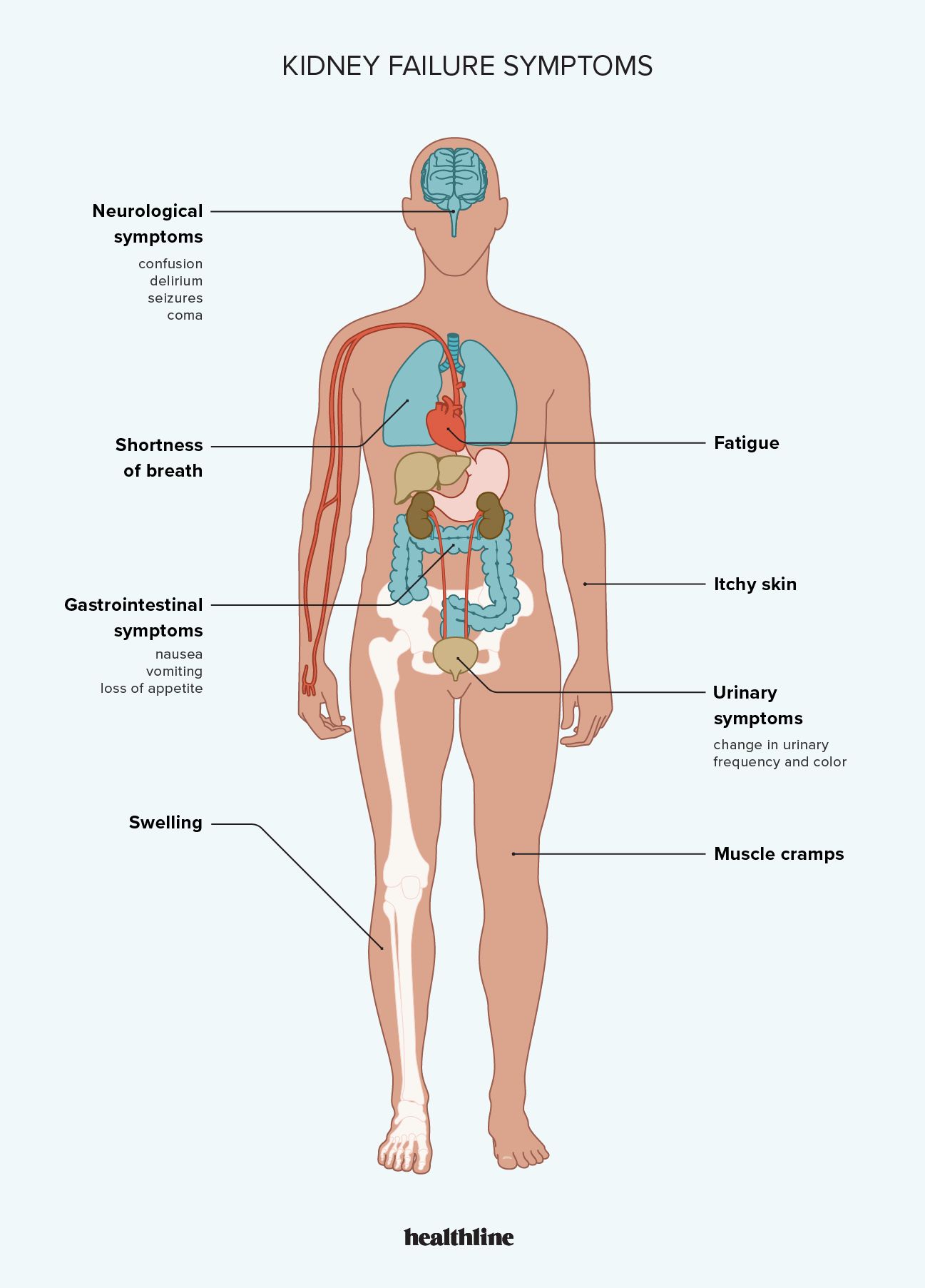 effects of kidney failure on various parts of the human body