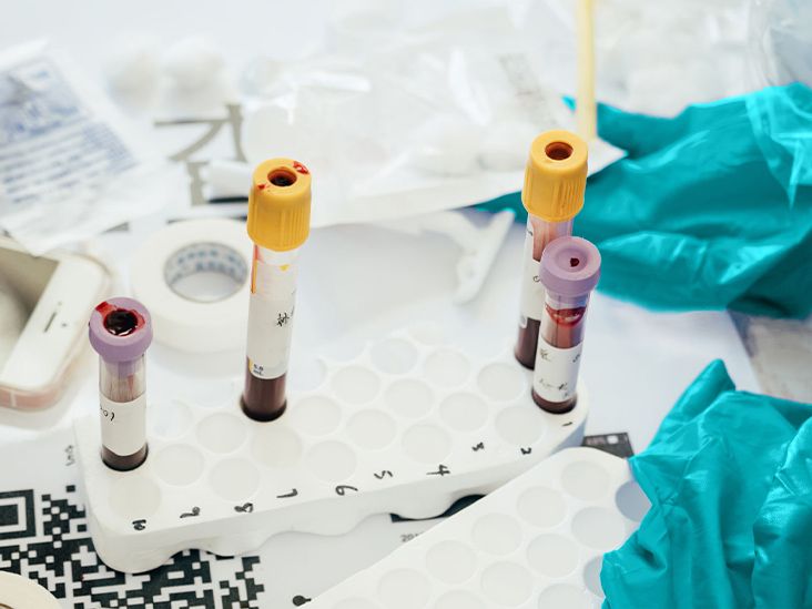 Experimental Blood Test May Help Detect Colon Cancer Earlier