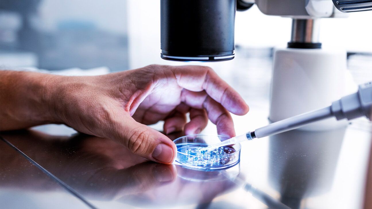 A person hold a peitri dish under a microscope.