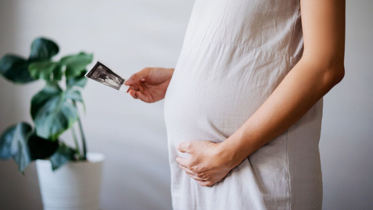 A pregnant person holding a sonogram photo.