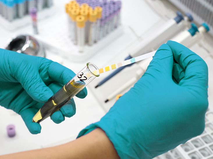 Diabetes Insipidus Which Lab Tests Are Used to Diagnose It?