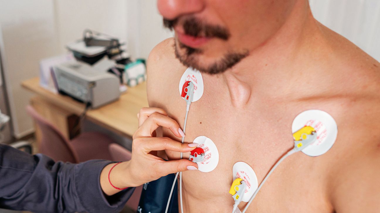 Close-up of person with electrode patches stuck to their chest to depict a electrocardiogram.