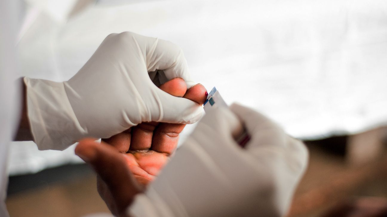 Close-up of a doctor wearing white latex gloves pricking a person's finger to perform a HIV blood test.