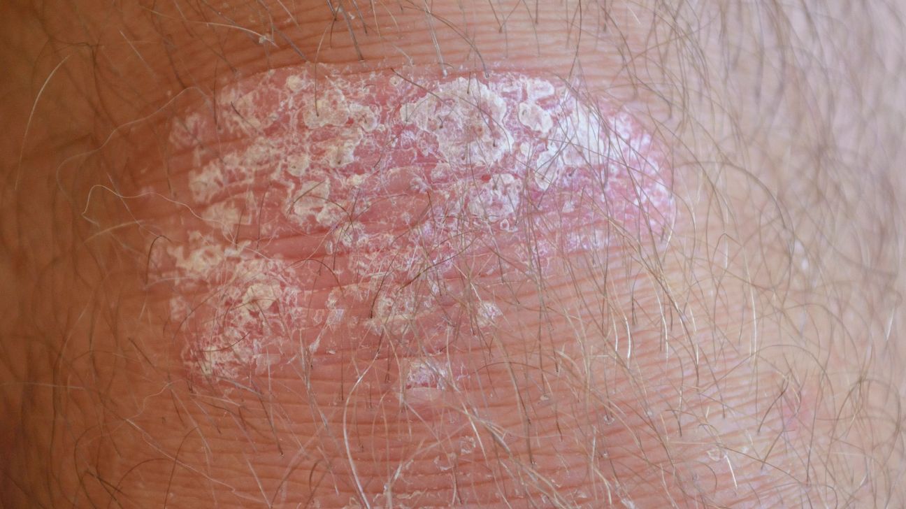 What Causes Dry Itchy Spots On Skin Infoupdate Org What Causes Dry Itchy Spots On Skin Infoupdate Org