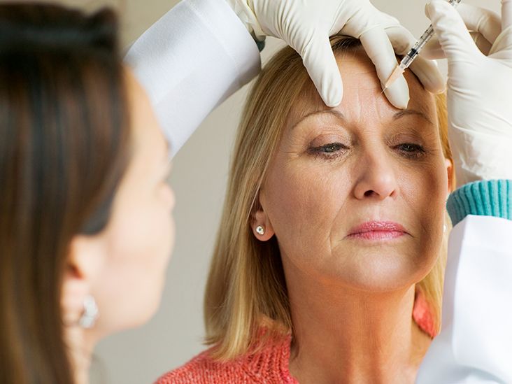 Where Is Botox Injected for Migraine?