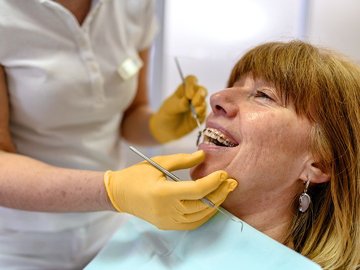 Does Medicare Cover Braces?