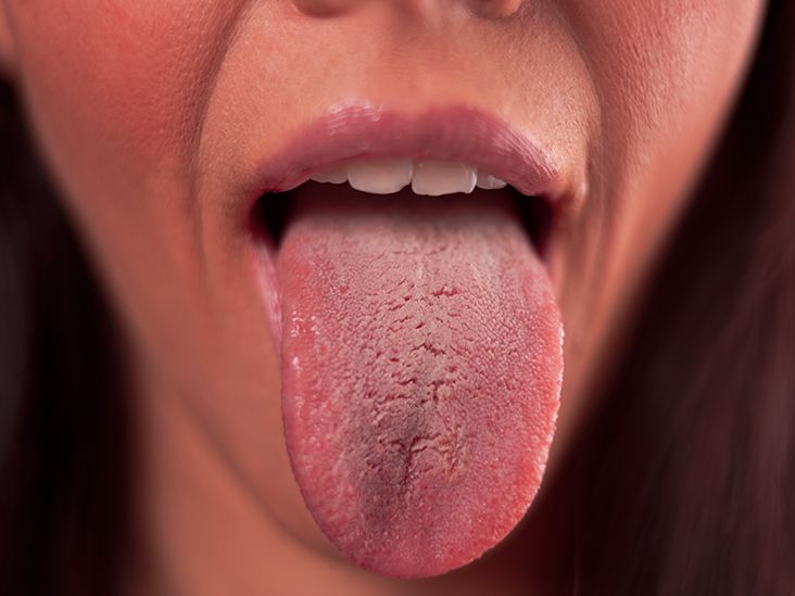 tirzepatide tongue Scraping, Oil Pulling & Weight Loss: A Holistic Approach Tirzepatide Medication Guide - Nervana