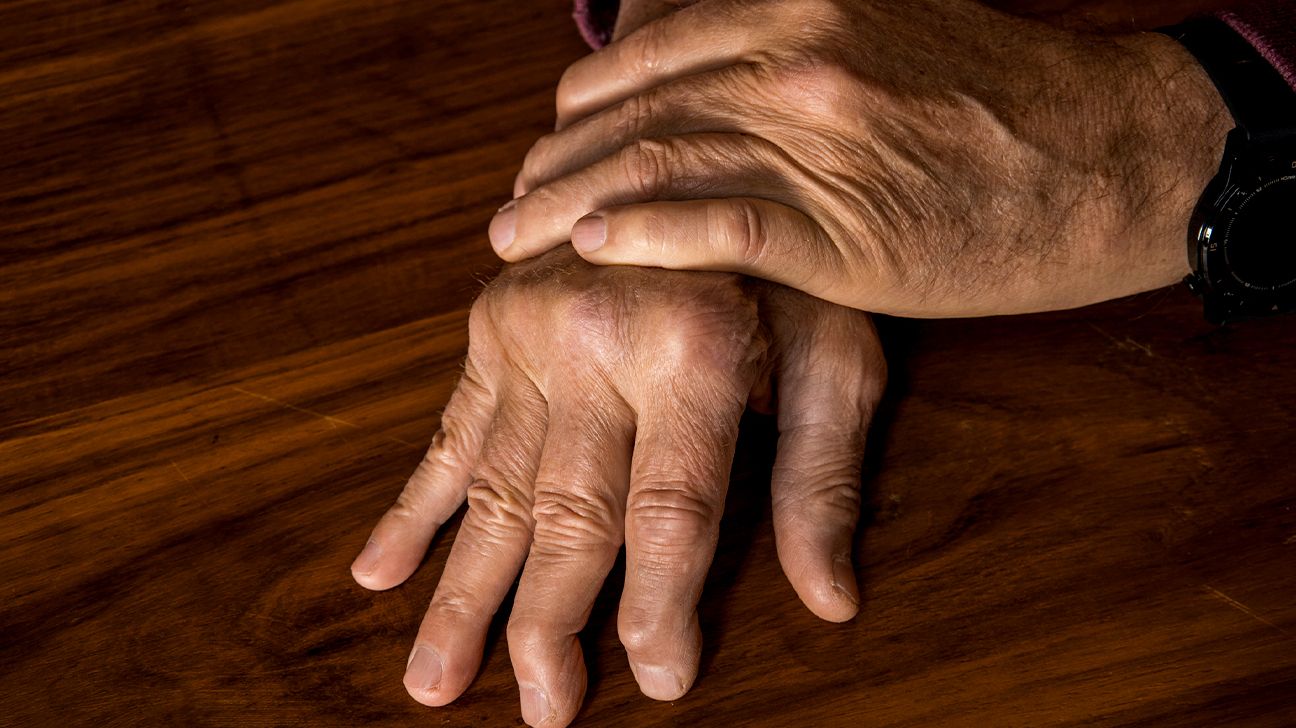 Swollen Hands 20 Causes and Treatment