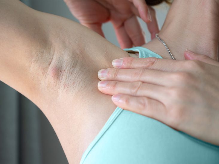 Armpit Pain Causes Treatment and More