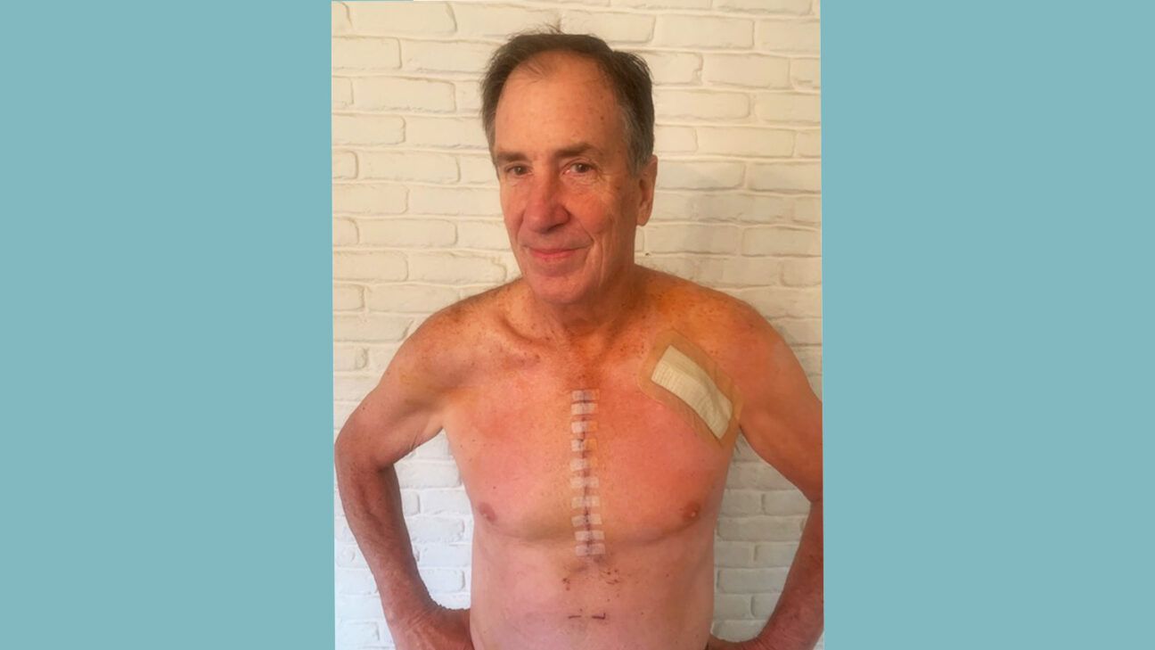 David Mills after open-heart surgery.