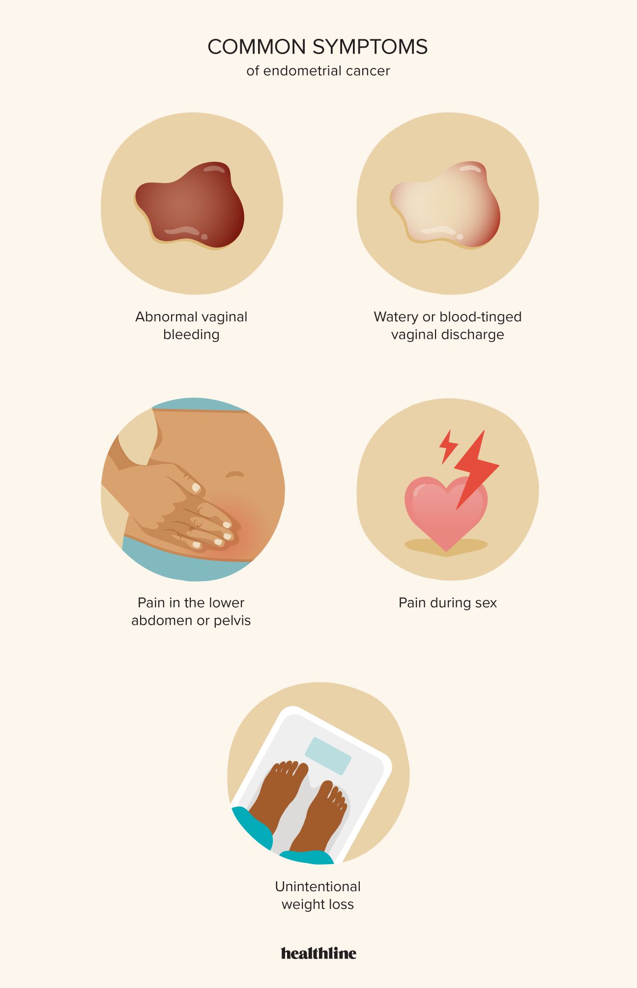 Symptoms-of-Endometrial-Uterine-Cancer