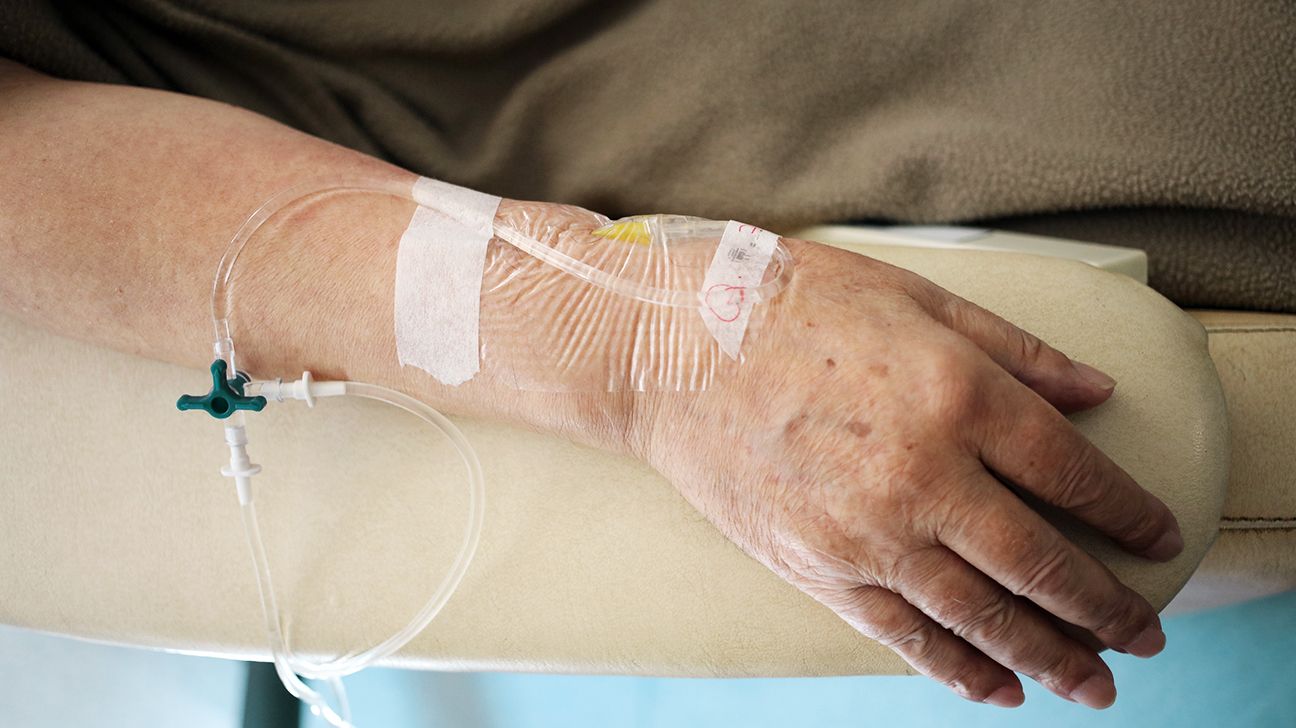 Close up of an older person's hand receiving chemotherapy drugs through an IV