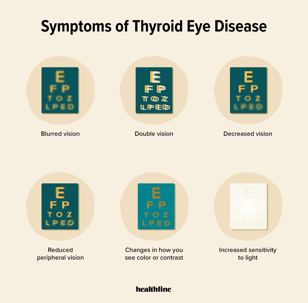 Symptoms of thyroid eye disease