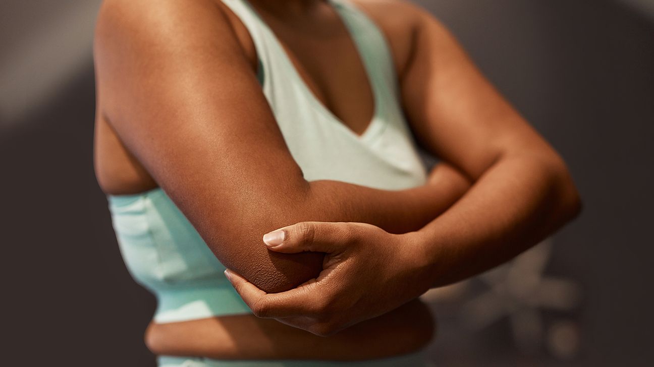 woman holding elbow as if in pain