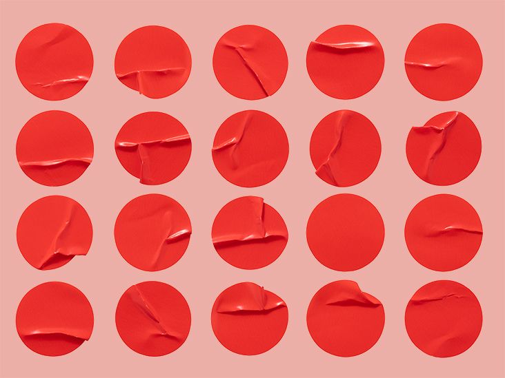 Penis Clog: Symptoms, Causes, and Treatment