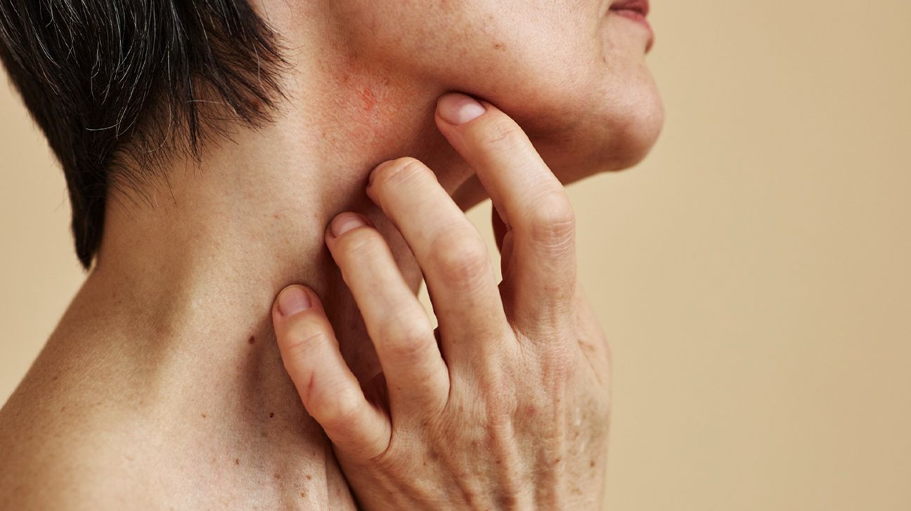 Woman with short hair scratching neck anxiety or skin condition