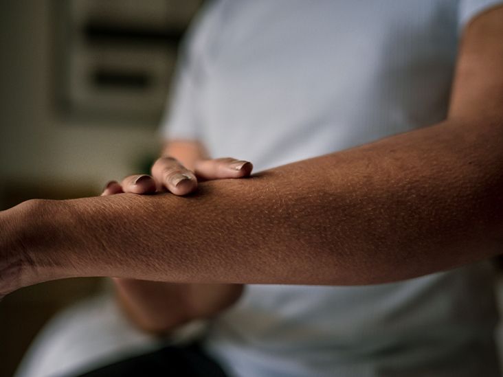 Formication: What You Need to Know About This Crawling Sensation