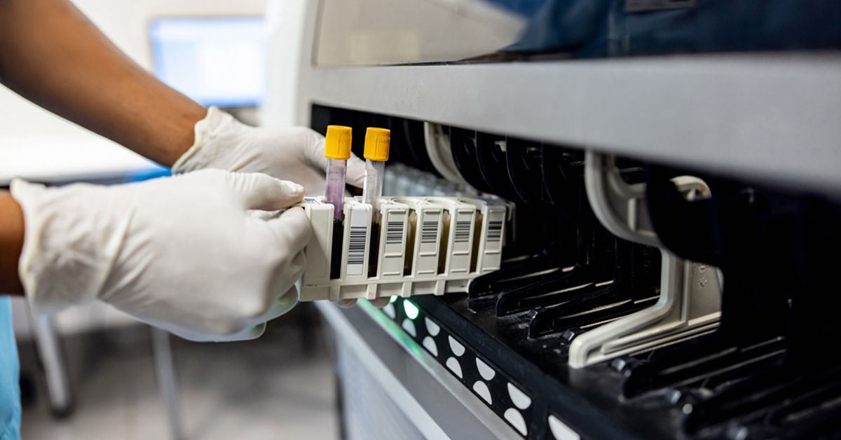 Health Line Lab Blood Tests For Parkinson's Disease: Where Are We Now?