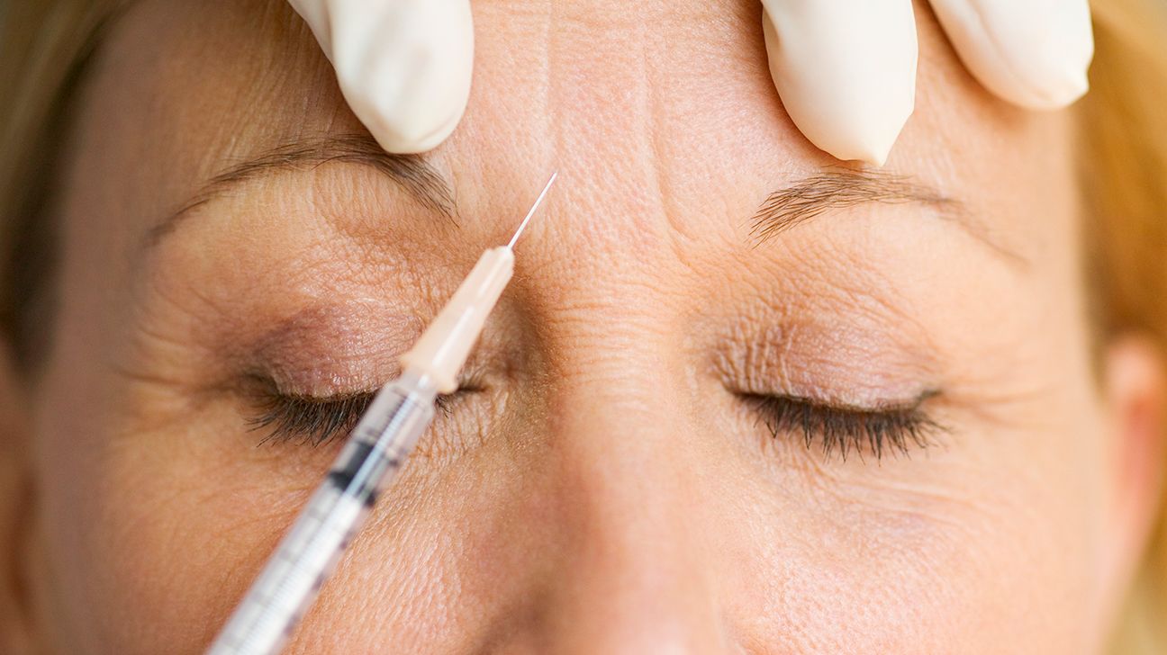 woman_face_botox_injection