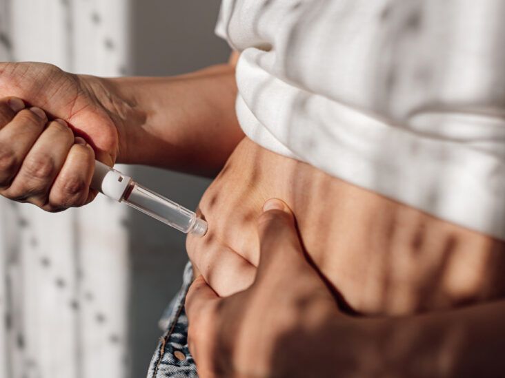 Zepbound (tirzepatide) on Reddit: Top Drug Questions Answered