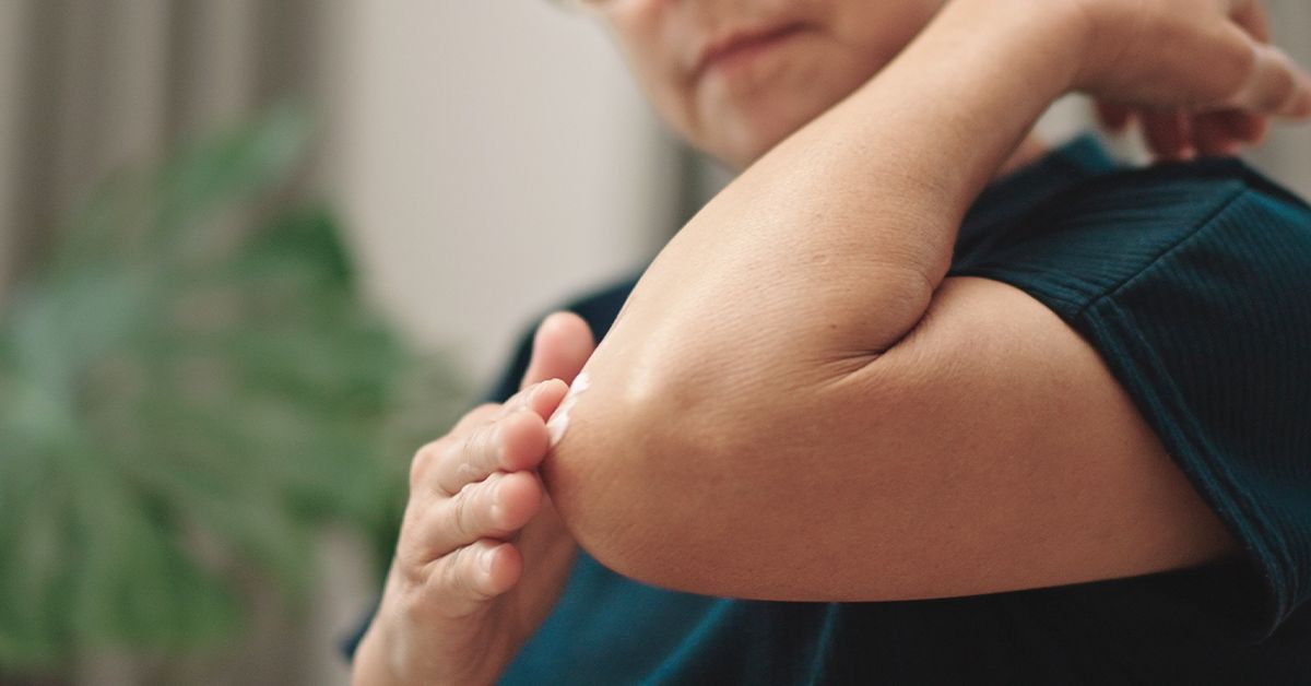 Dark Elbows: Causes, Home Remedies, and More