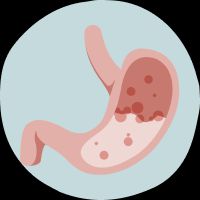 Digestive issues