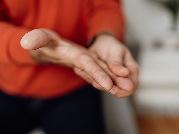 Does Diabetes Lead To Trigger Finger?