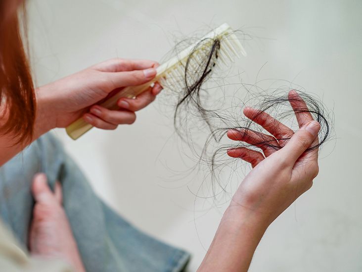 Do Hair Loss Treatments for Women Actually Work? What Experts Think