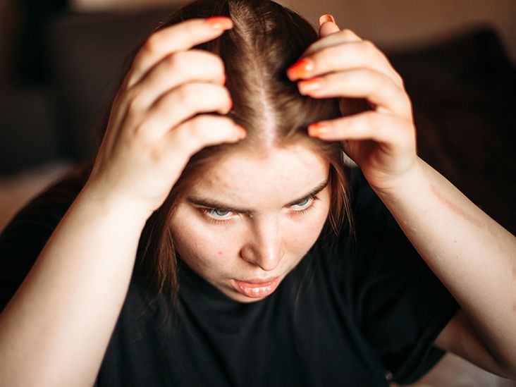 Can GLP-1s Cause Hair Loss?