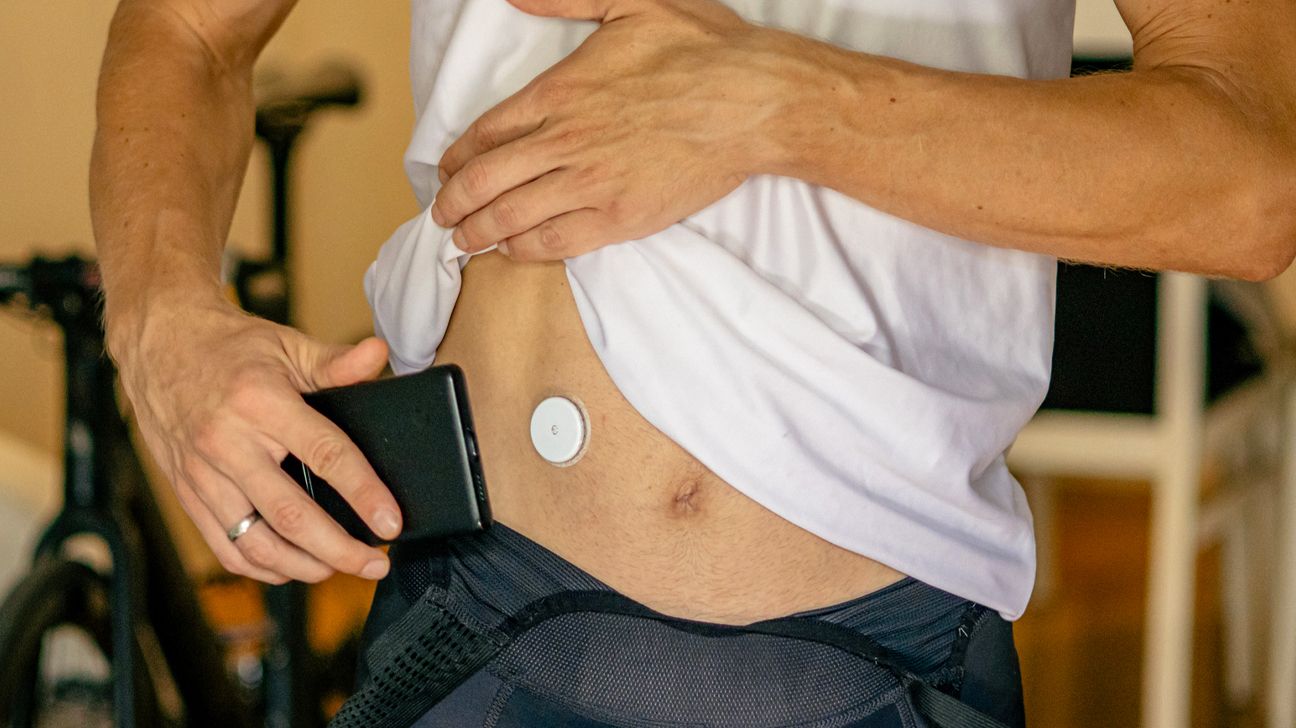 애보트 프리스타일 리브레 CGM