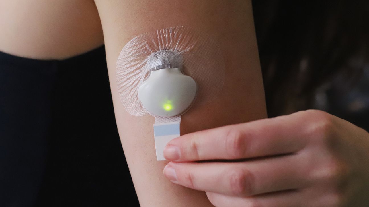 메드트로닉 미니메드 CGM 센서