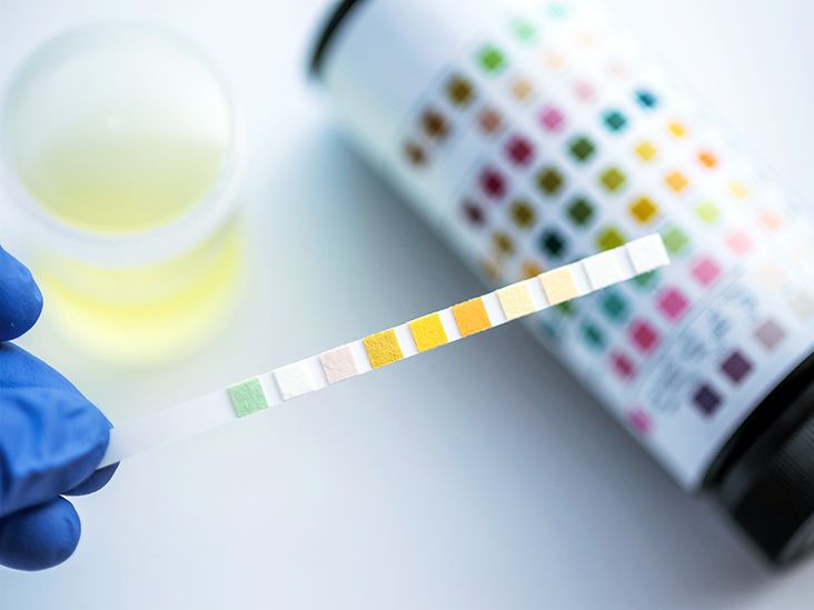 What Is a Urine Protein-Creatinine Ratio (UPCR) Test?