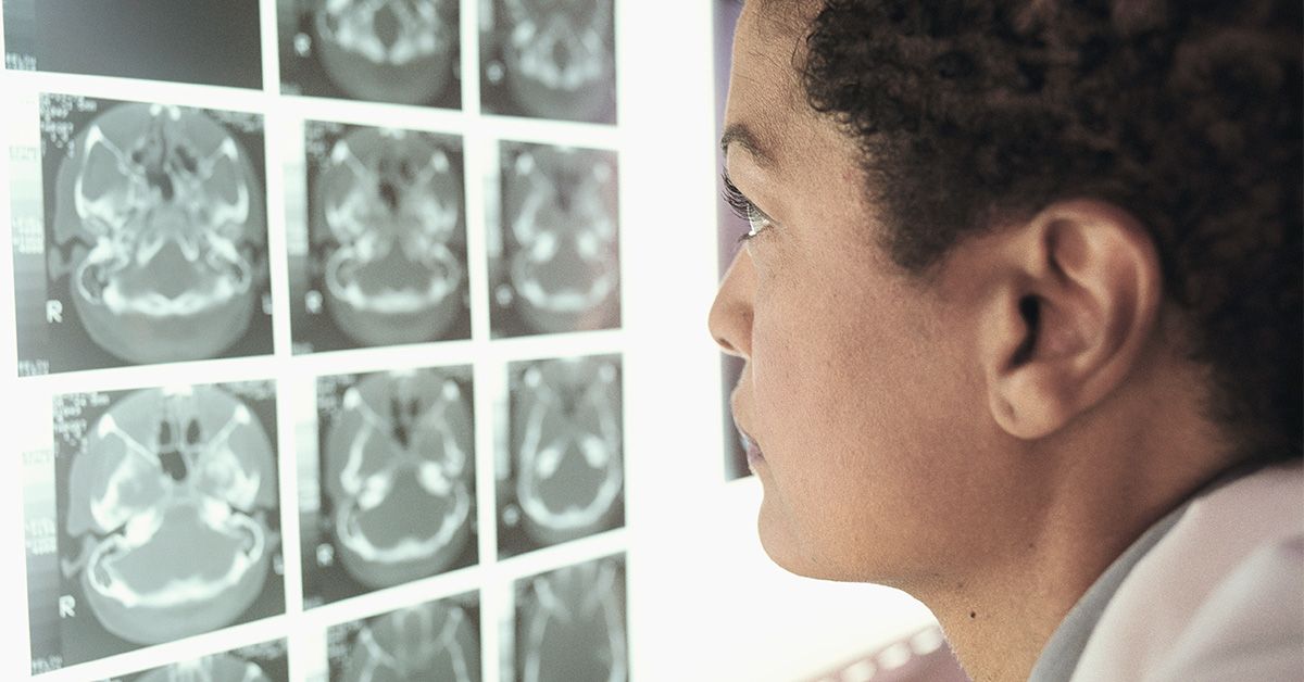 IgG4-Related Disease: Symptoms, Treatment, and Outcome