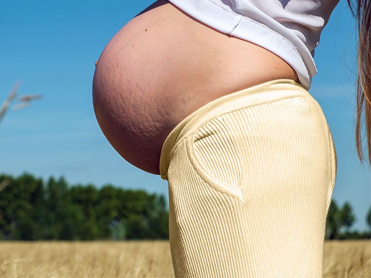 No Link Between Tylenol Use During Pregnancy and Autism, Review Finds