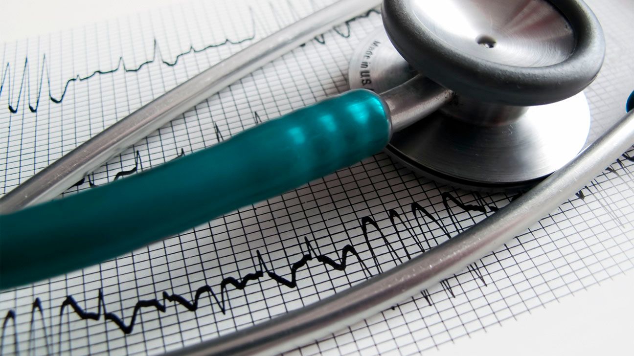 Stethoscope on heart rate monitoring paper