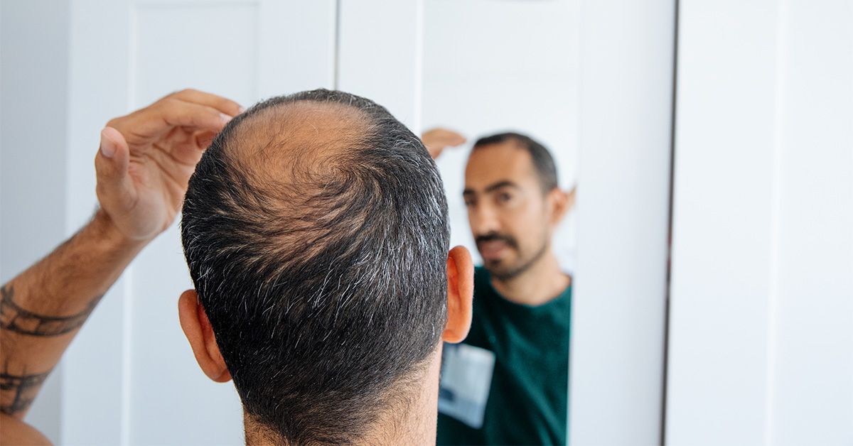 Самые эффективные методы лечения выпадения волос в 2026 году, по мнению экспертов.