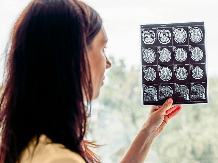 FDA Doesn't Endorse Leucovorin for Autism, OKs It for Rare Brain Disorder