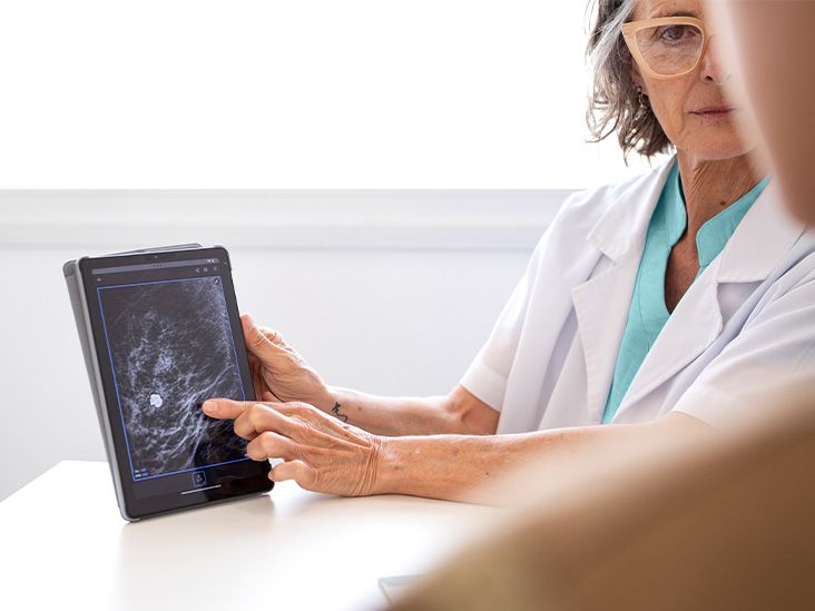 Obesity Driving 10% of Cancer Diagnoses, Review Finds. How to Lower Your Risk