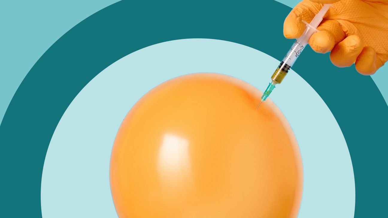 Graphic of a hand injecting a balloon with a needle