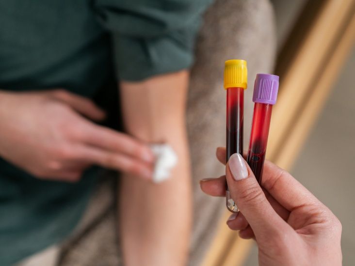 A Simple Blood Test Catches Polyps, Early-Stage Colorectal Cancer