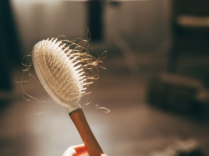 Alopecia: Common Arthritis Drug Shows Promise for Hair Regrowth