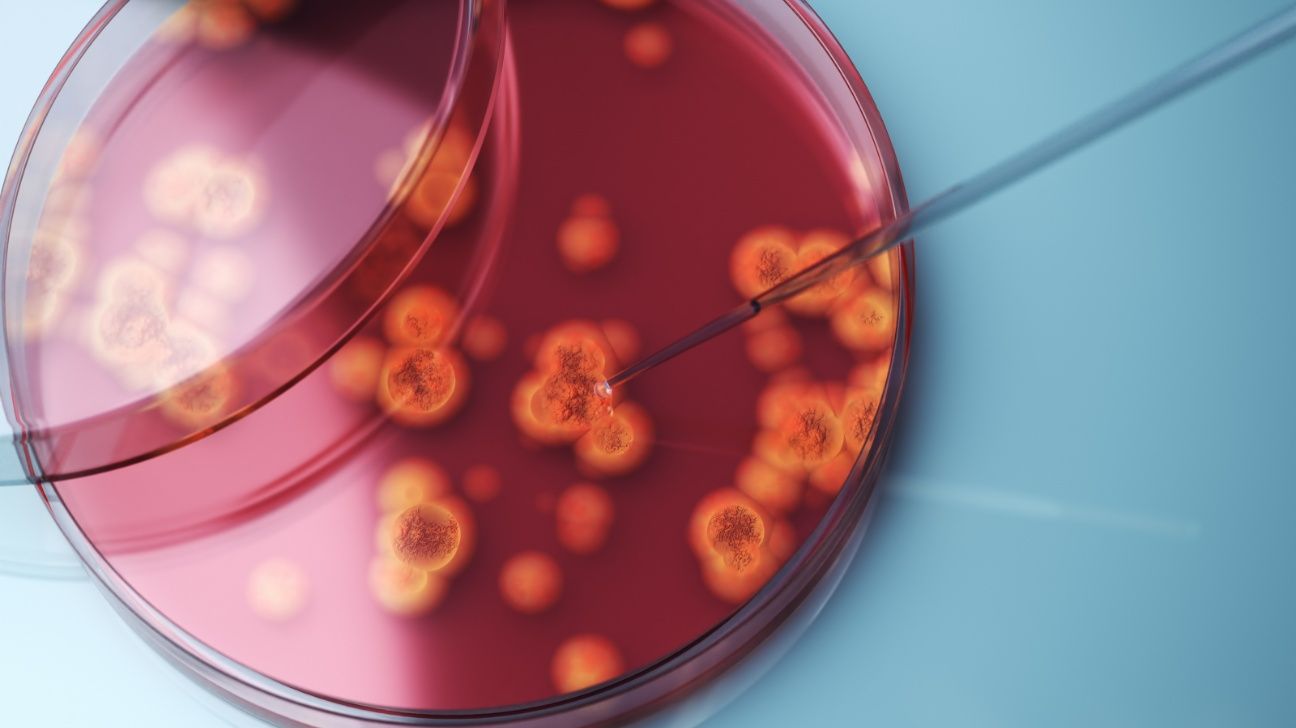 Close up of fungal bacteria in petrie dish